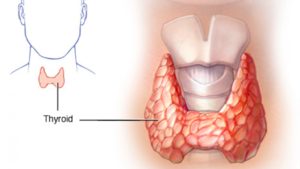 thyroid