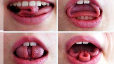 Trixie Tongue Tricks